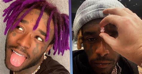 Rapper Lil Uzi Vert Gets A Pink Diamond Inserted Into His Head For
