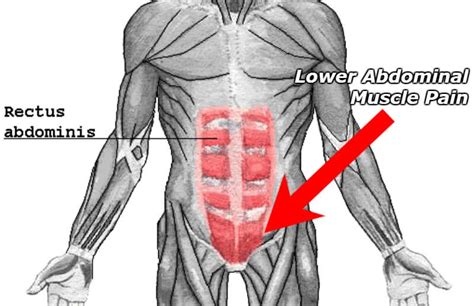 Muscle Strain Lower Left Abdomen Ovulation Symptoms