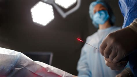 Ενδοαυλικό Laser Νέο όπλο κατά της φλεβικής ανεπάρκειας και των κιρσών