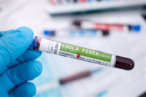 Gor Czka Krwotoczna Ebola Denga I Inne Jakie Objawy