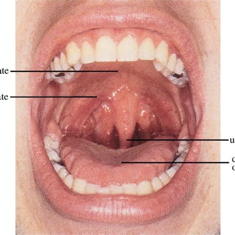 A View Into The Oral Cavity Image Sob Download Scientific Diagram