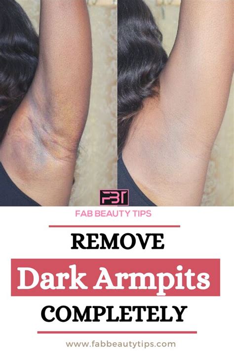 Get Rid Of Dark Armpits In A Week Fab Beauty Tips Dark Spots Under