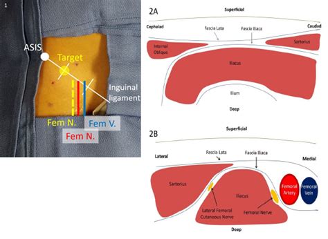 Femoral Nerve Block Anatomy Anatomy Structure