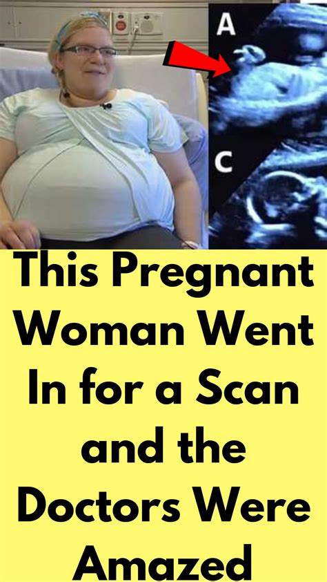This Pregnant Woman Went In For A Scan And The Doctors Were Artofit