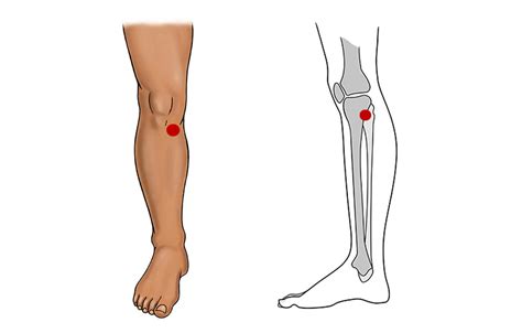 Press These Points To Reduce Knee Pain Naturally The Pcn Channel