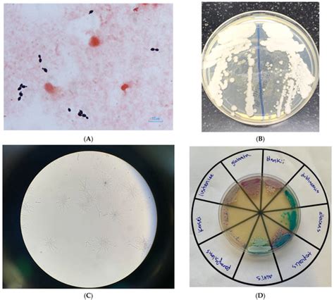 Jof Free Full Text The Continuing Emergence Of Candida Blankii As A