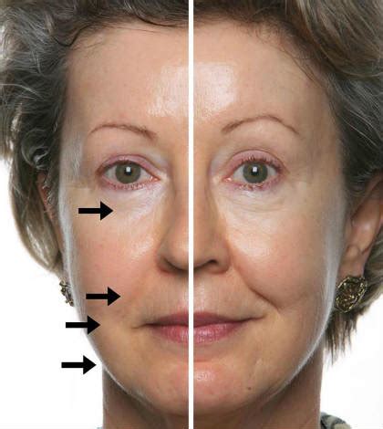 Suggest as a translation of galvanic treatment copy Galvanic Skin Treatment or Galvanic Facial