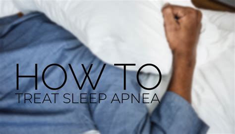 how to treat obstructive sleep apnea