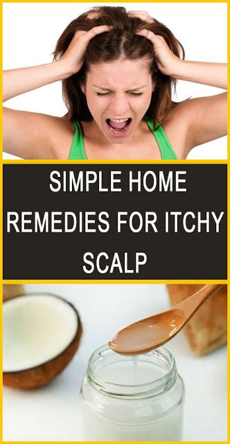 Simple Home Remedies For Itchy Scalp Beauties Natural Itchy Scalp