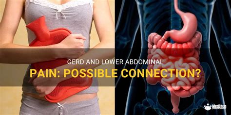 Gerd And Lower Abdominal Pain Possible Connection MedShun