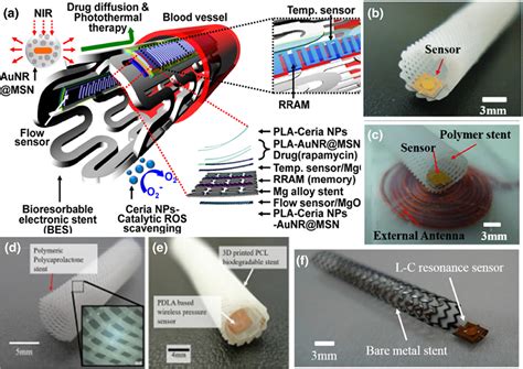 Perspectives On Smart Stents With Sensors From Conventional Permanent