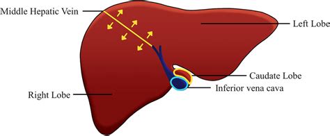 Illustration Of The Ground Truth For The Left Lobe Right Lobe And Download Scientific Diagram