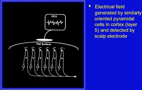 Slide 16 Physiological Basis Of The Eeg An Introduction To