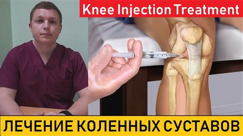 Knee Injection Treatment Внутрисуставные инъекции в коленный сустав Youtube