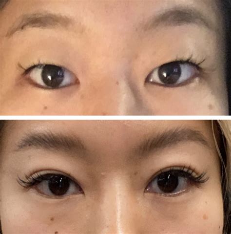 Eyelid Qanda How I Went From Monolids To Double Lids — Rrayyme