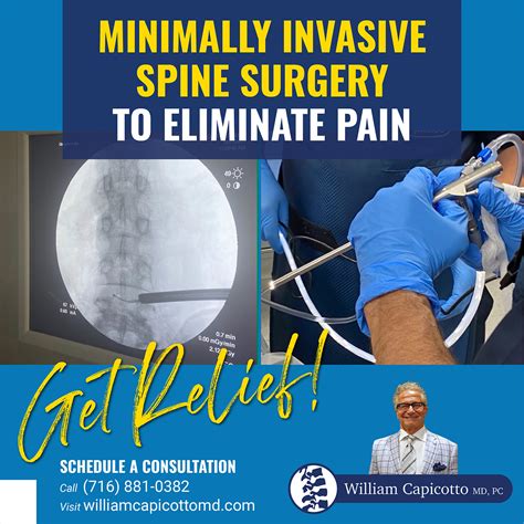 Minimally Invasive Spine Surgery To Eliminate Pain William Capicotto