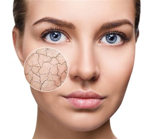 20 Reasons Why Your Face Is Dry The Dermatology Review