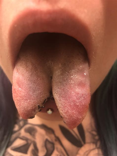 Tongue Split Telegraph