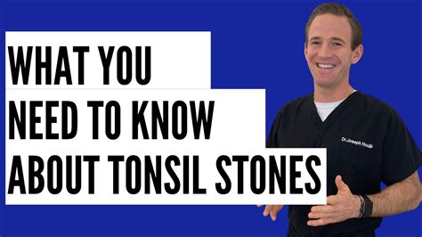 Ask Dr H What You Need To Know About Tonsil Stones Youtube