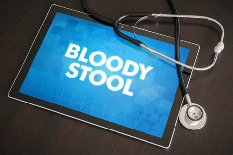 Common Causes Of Bloody Stool Downriver Gastroenterology P C
