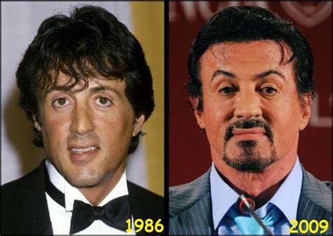 Celebrities Then And Now 28 Pics Celebrities Then And Now Plastic