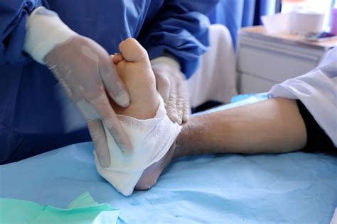 Clínica de tratamiento avanzado de Heridas y Pie Díabético San José