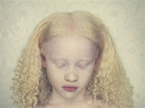 Criança Albina Modelo Albino Fotografia Fotografia Contemporânea