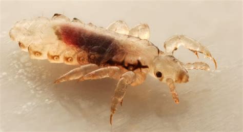 Head Lice Bans From School Outdated Cbc News