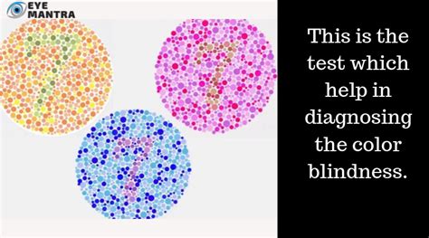 Colour Blindness Types Causes Surgery And Treatment Eyemantra
