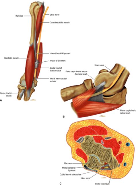 Entrapment Neuropathies Of The Upper Extremity Musculoskeletal Key