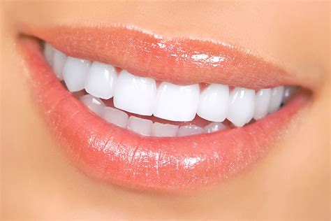 Why Should We Choose Veneers To Get A Brighter And Perfect Smile