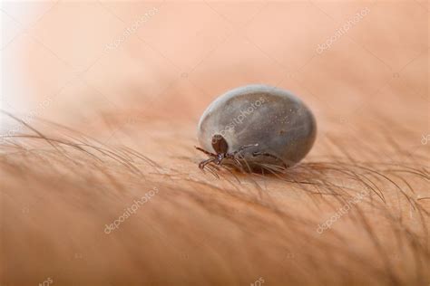 Detail Tick Parasite On Leather Stock Photo By ©pitrs10 2441504