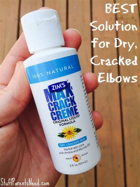 Dry Cracked Elbows What Works To Eliminate Them Herbal Skin Care