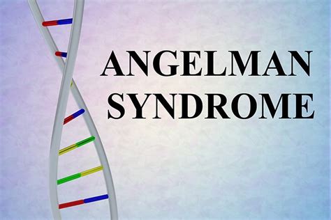What Is Angelman Syndrome Causes Symptoms And Treatment Baby Care Guide