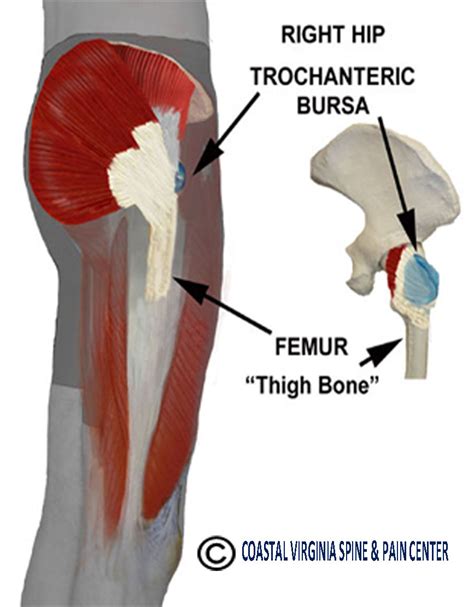 Trochantericbursa Coastal Virginia Spine And Pain Center