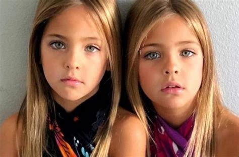 The Most Beautiful Twins In The World Their Life Many Years After