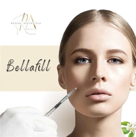Bellafill Is A Dermal Filler Thats Fda Approved To Treat Nasolabial
