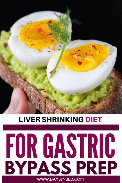 Liver Shrinking Diet For Gastric Bypass Patients The Instant Pot Table