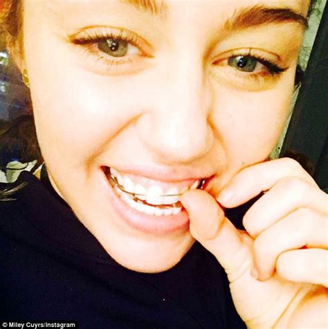 Miley Cyrus Puts Friends Retainer On Her Teeth To Pose For A Selfie