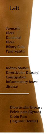 Kidney Pain Vs Right Left And Central Abdominal Pain La Vaca Cega