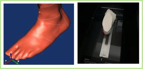 Left A Foot`s 3d Scan Right Plaster Cast Of The Foot Download