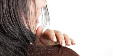 How Dandruff Shampoo Works | ReviewThis