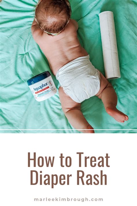 How To Treat Diaper Rash Diaper Rash Treating Diaper Rash Newborn Diapers