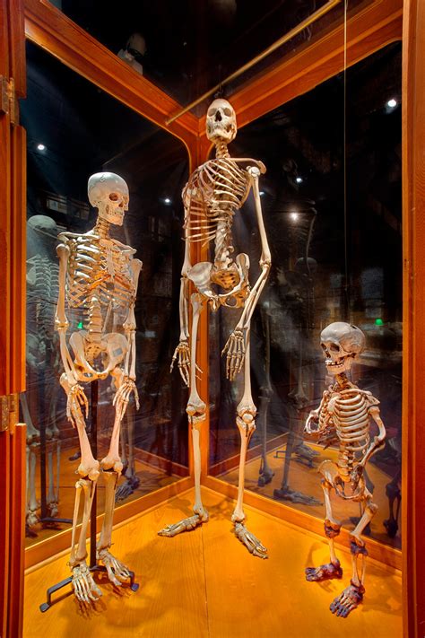 Skeletons Of The American Giant And Mary Ashberry Drawf With Average