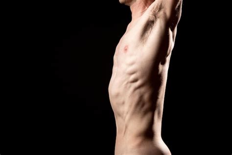 Side View Of A Muscular Naked Man With Sunken Chest Or Pectus Excavatum Hot Sex Picture