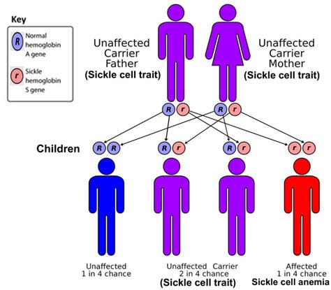 Sickle Cell Anemia Causes Fenetics Symptoms Diagnosis Treatment Prognosis