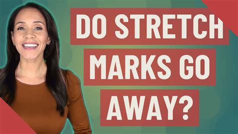 Do Stretch Marks Go Away Youtube