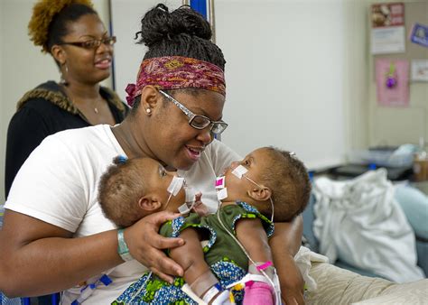 Kendra And Maliyah Herrin Formerly Conjoined Twins Thriving 7 Years