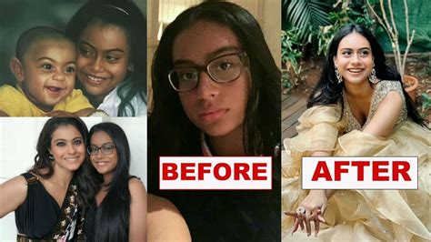 Kajol Daughter Nysa Devgan Amazing Transformation After Surgery Ajay