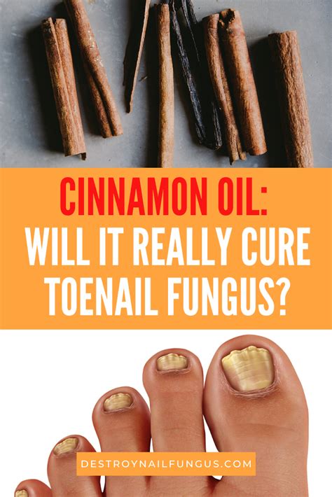 Never apply essential oils directly to cats, feed oils to cats, or leave oils in areas where they may come in direct contact with cats. Cinnamon Oil For Toenail Fungus - Does It Really Work?